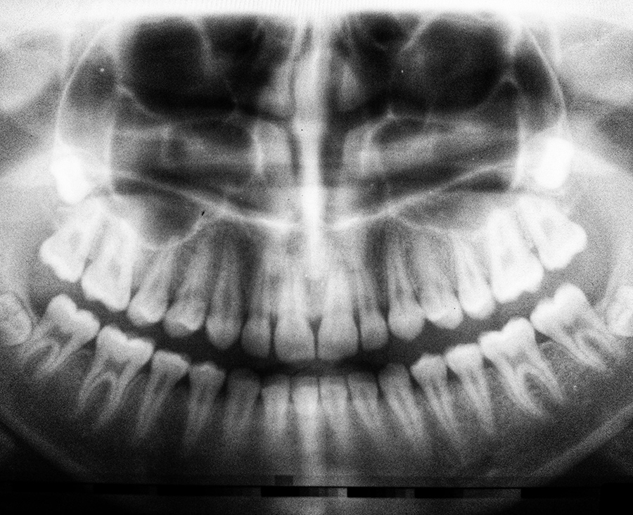 -Smile Dent Clinics - Implantologie Orală Estetică Dentară Stomatologie Digitală-radiologie