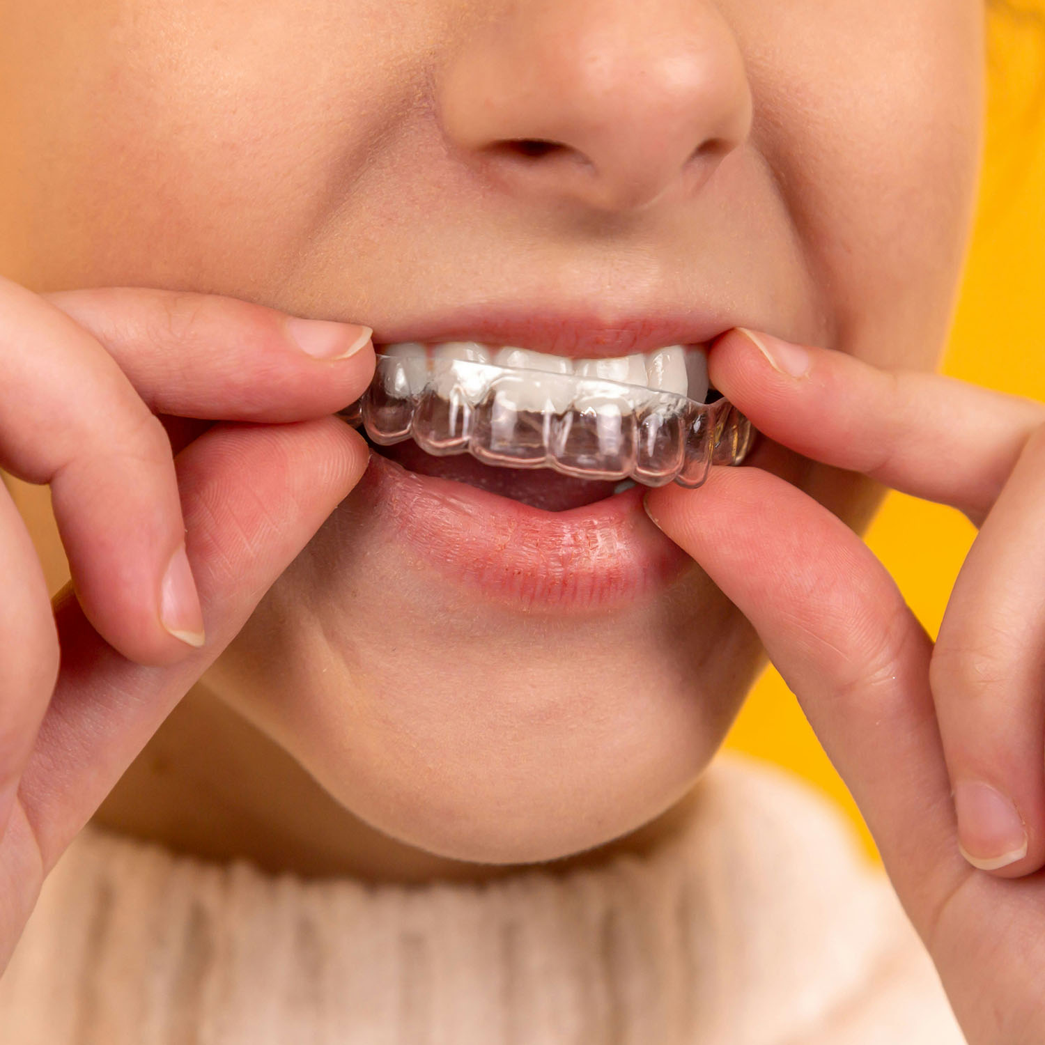 Smile Dent Clinics - Implantologie Orală Estetică Dentară Stomatologie Digitală
