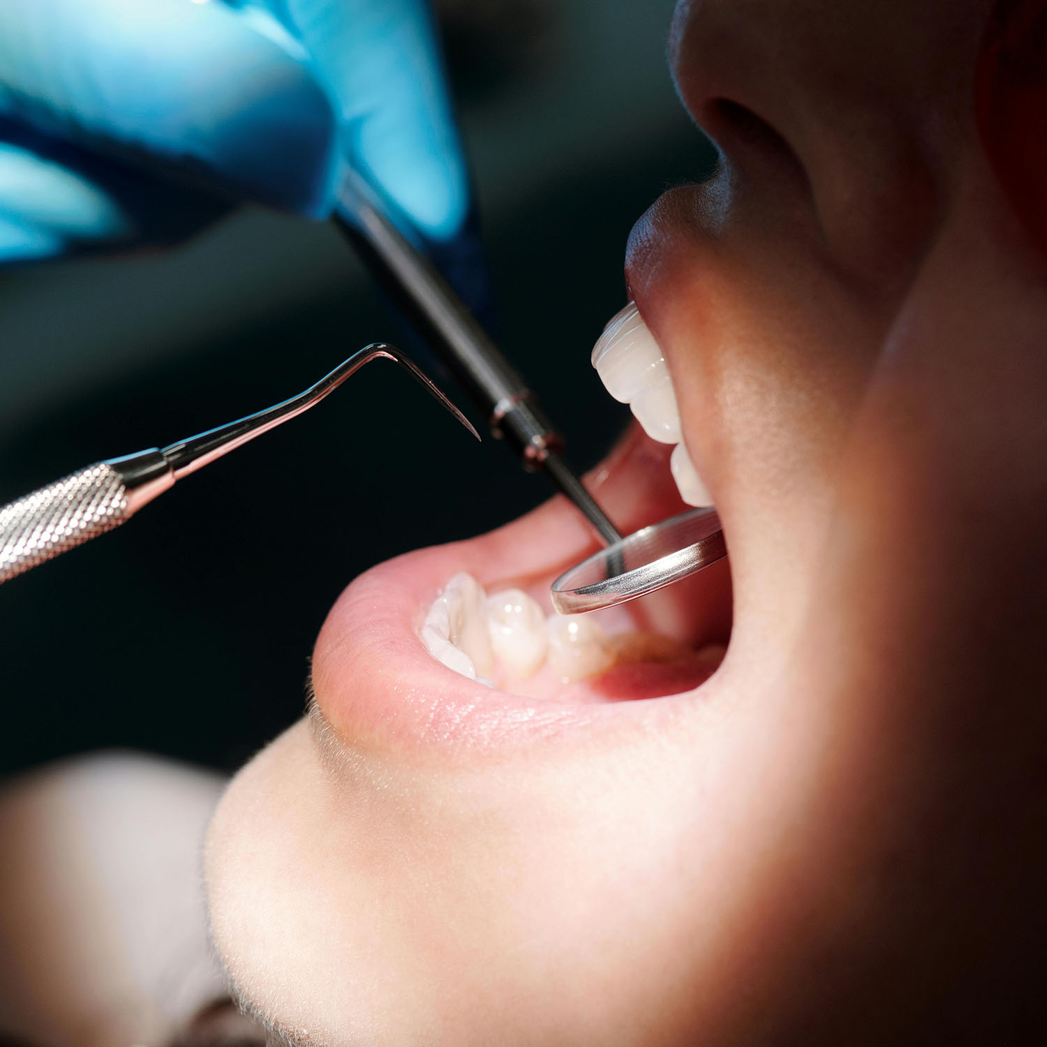 Smile Dent Clinics - Implantologie Orală Estetică Dentară Stomatologie Digitală
