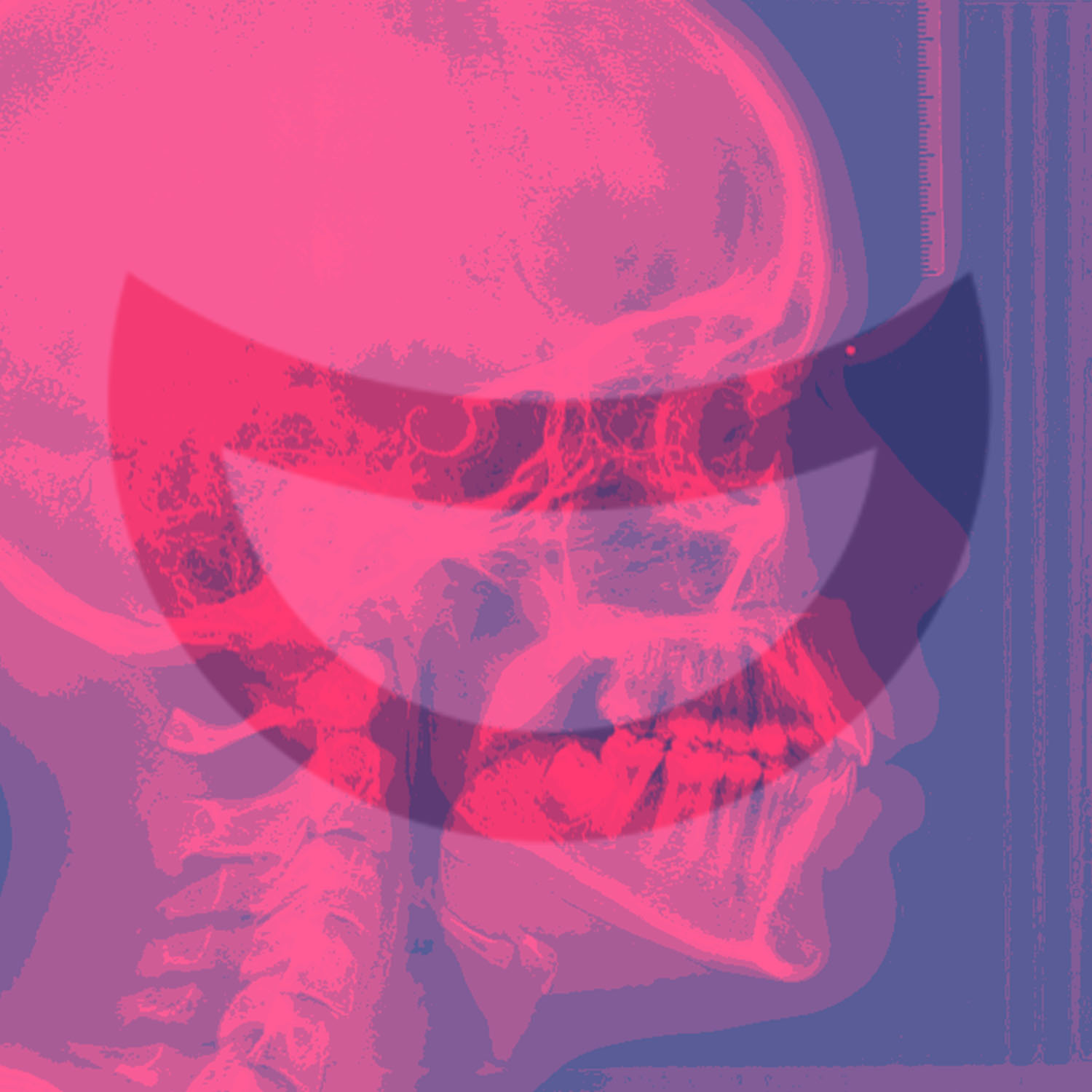 Smile Dent Clinics - Implantologie Orală Estetică Dentară Stomatologie Digitală