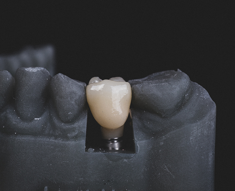 -Smile Dent Clinics - Implantologie Orală Estetică Dentară Stomatologie Digitală-Implantologie